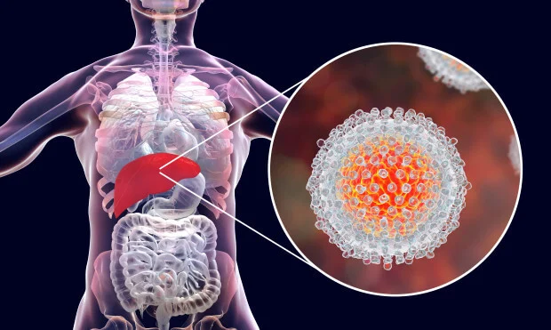 Kronik Hepatit C Nasıl Bulaşır?