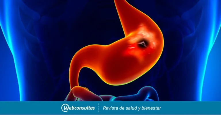 dispepsi