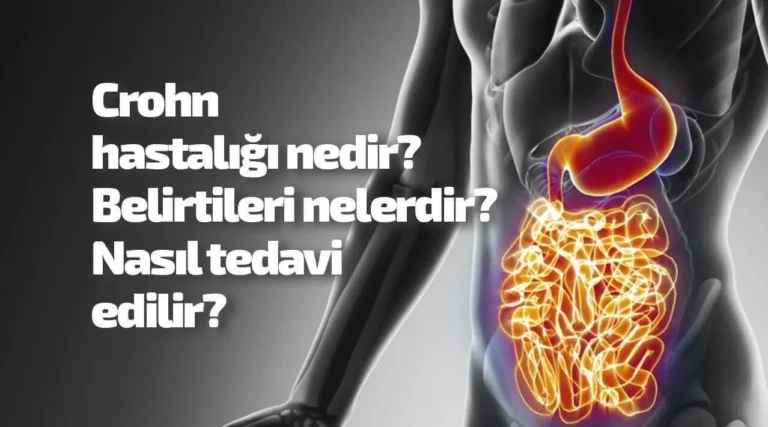 Crohn hastalığı nedir?
