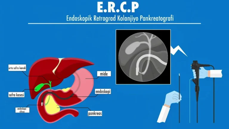 ERCP Nedir?