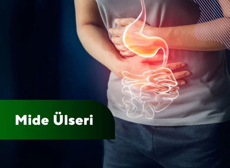 Mide ülseri nedir?